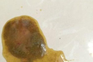 泰迪狗细小中期症状及防治方法（揭秘泰迪狗细小中期症状，提供有效防治方法）