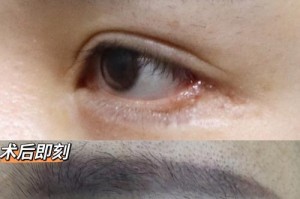 眼珠为什么会变白？（探究眼珠白化的原因及相关健康问题）