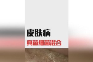 以杜高犬真菌皮肤病为主题的治疗方法（提升宠物健康的实用指南）