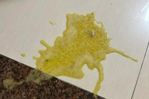 猫咪呕吐黄水的原因及处理方法（解析猫咪呕吐黄水的背后问题，宠物健康必读）
