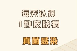 深夜降临，泰迪皮肤病痒得难以入眠（探寻夜晚泰迪皮肤病痒的原因及缓解方法）