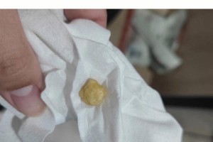 如何使狗狗排出结石（为你的爱犬带来福音的两种有效方法，让结石不再是问题）