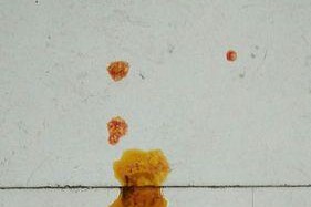 犬瘟热拉屎症状全解析（了解犬瘟热拉屎的症状，提早预防和治疗）