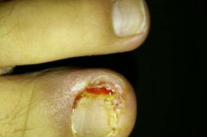 小狗脚被踩瘸多久能好？（了解小狗脚部受伤的康复时间和方法）