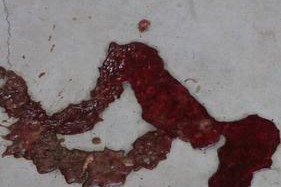 狗严重拉血应该如何处理？（了解狗拉血的原因及药物治疗方法）