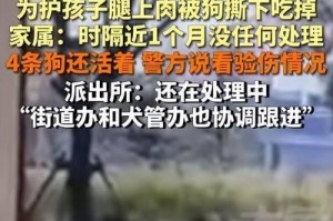 揭秘狗为何喜欢咬人的原因（探究狗的天性，寻找解决咬人问题的方法）
