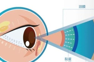 泪腺位置及其功能解析（揭开泪腺的秘密，探寻眼泪的故事）