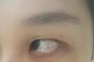 常见原因导致眼睛经常红的问题（揭秘眼睛红肿的背后原因及应对方法）
