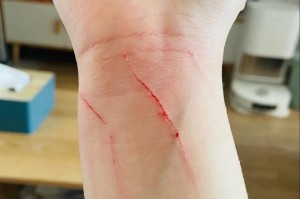 狗抓为什么会得狂犬病？（探索狗抓传播狂犬病的原因与预防措施）