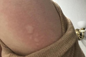 对小狗过敏的原因及处理方法（了解过敏原因，解决小狗过敏问题，小狗过敏）